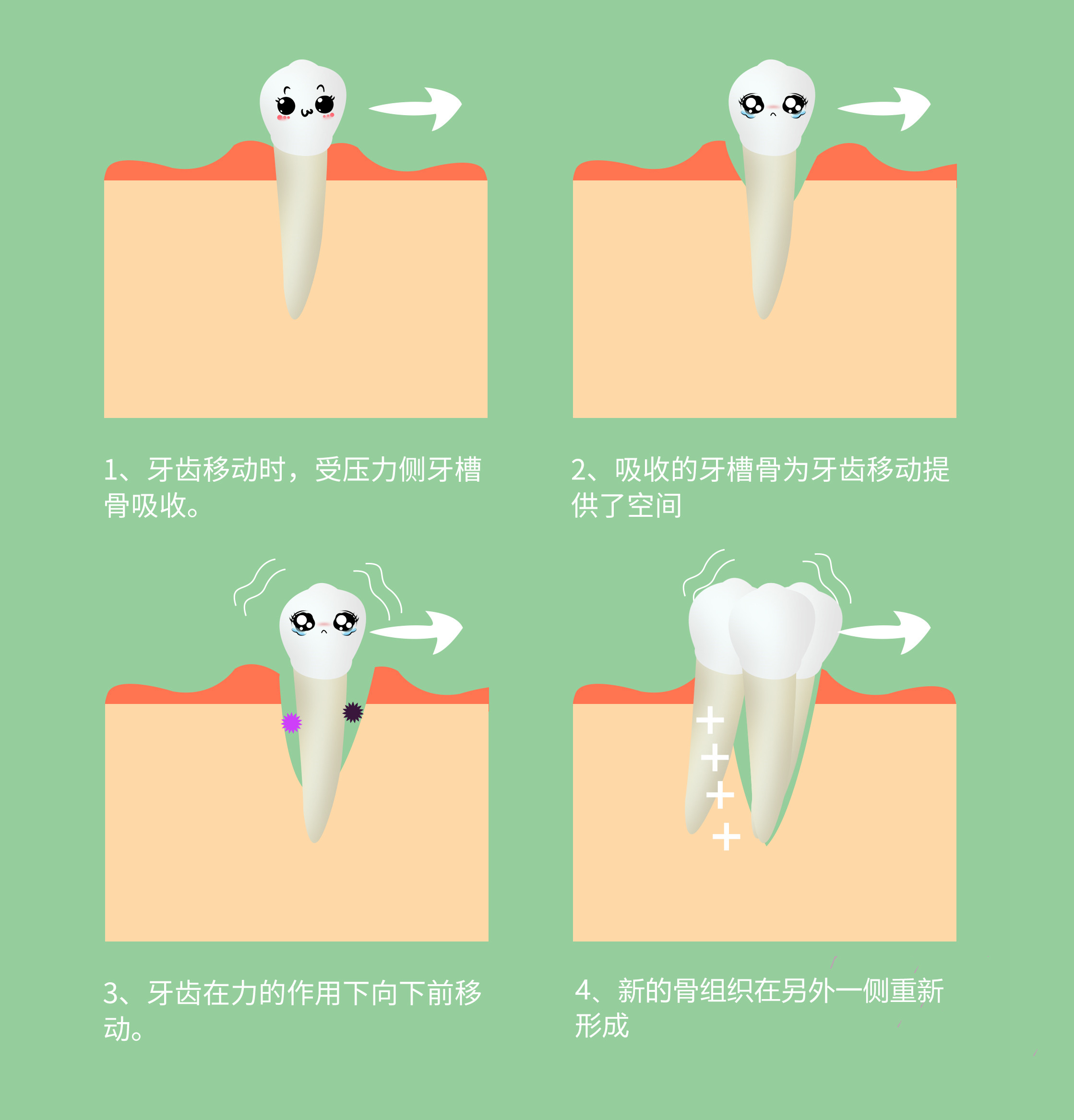 牙齿矫正过程